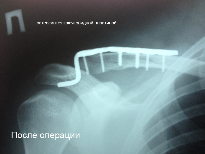 Расписание работы врачей поликлиники в десногорске